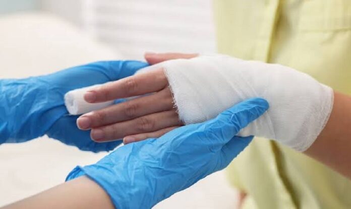The Real Costs and Recovery Pathways After a Burn Injury in Denver