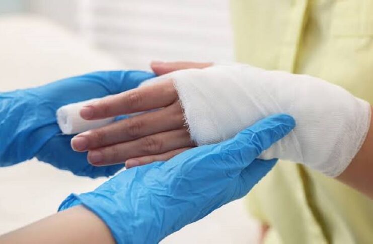 The Real Costs and Recovery Pathways After a Burn Injury in Denver
